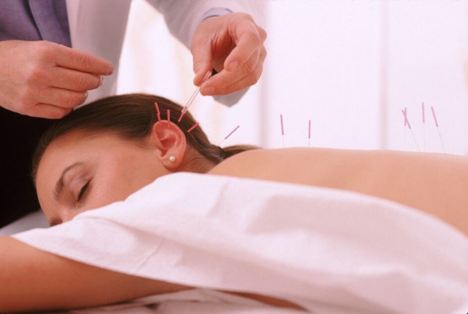 Acupuntura e acupuntura con osteocondrose cervical